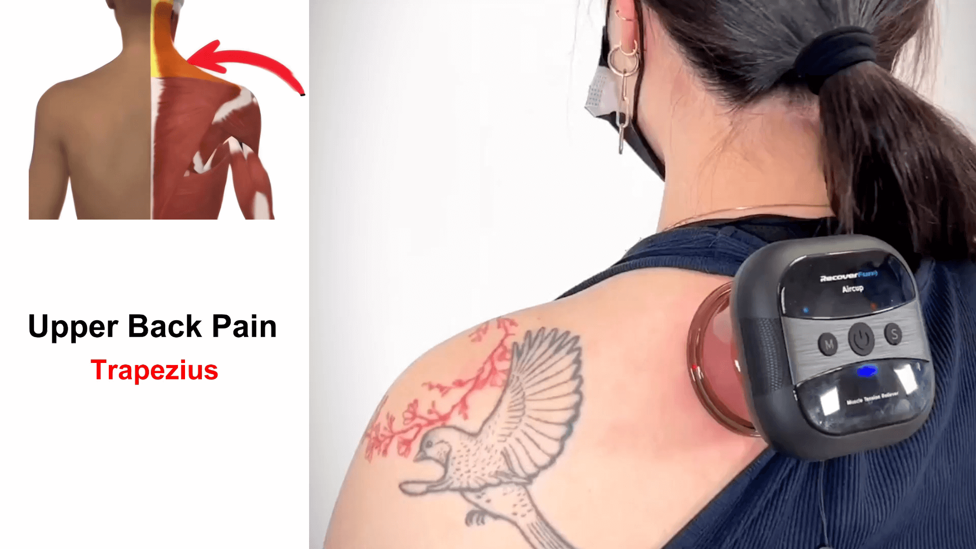 Load video: Upper Back Pain Trapezius Release | Recoverfun Cupping Massager