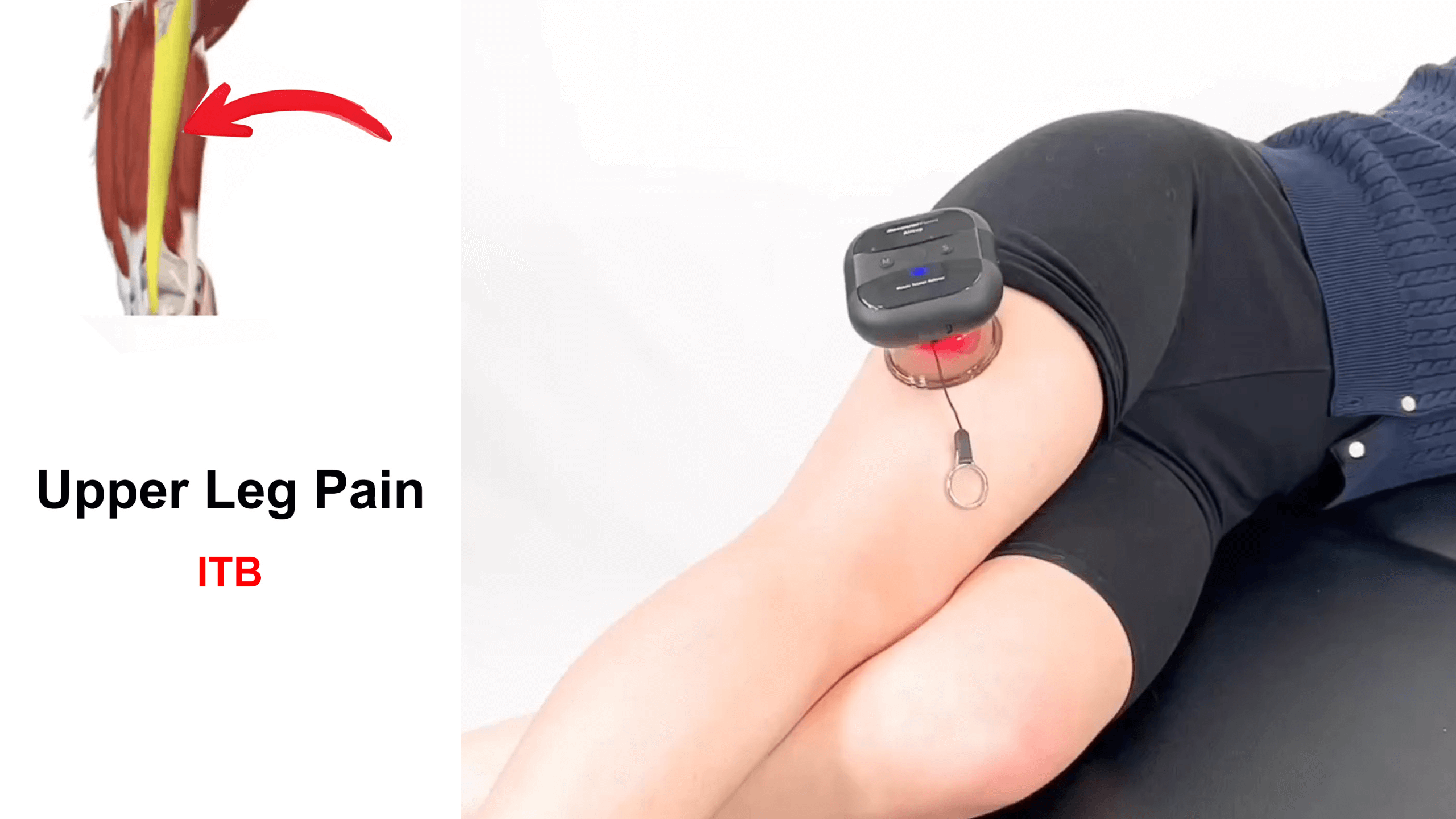 Load video: Upper Leg Pain Release | Cupping Massage for ITB