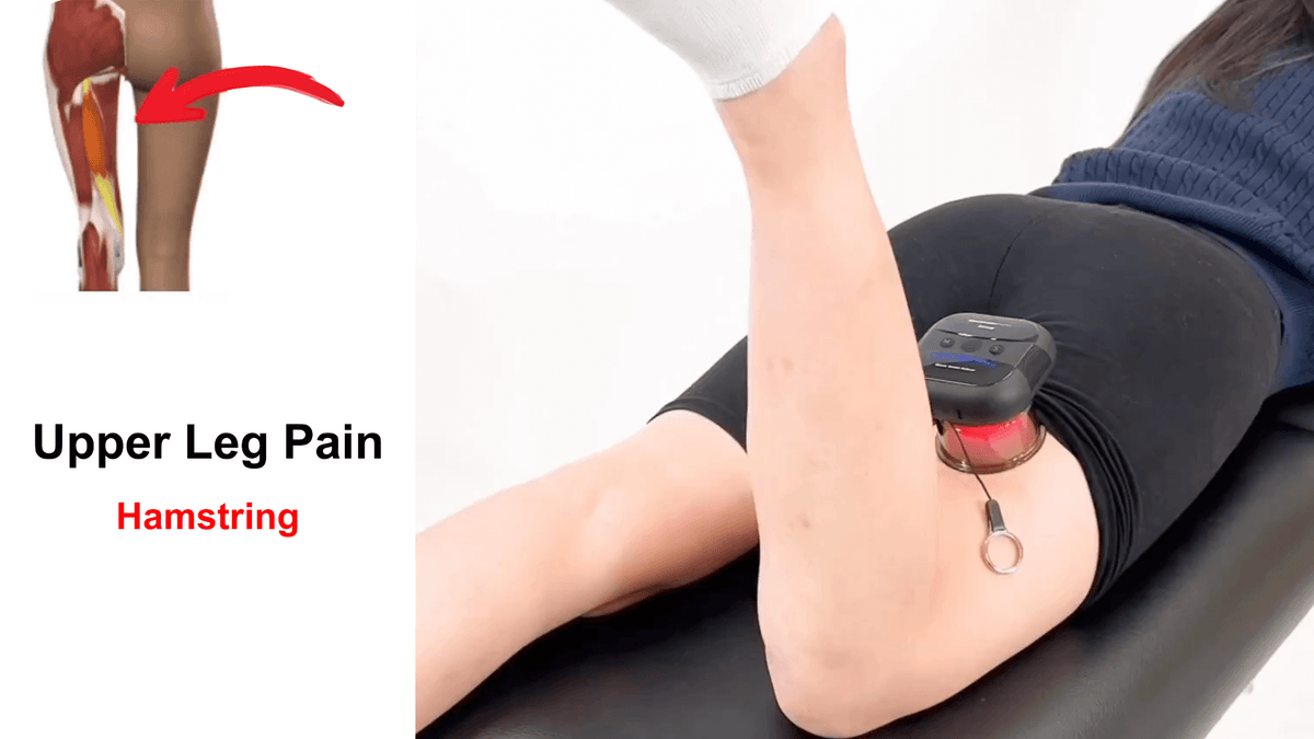 How To Use Smart Cupping Massagers – RecoverFun
