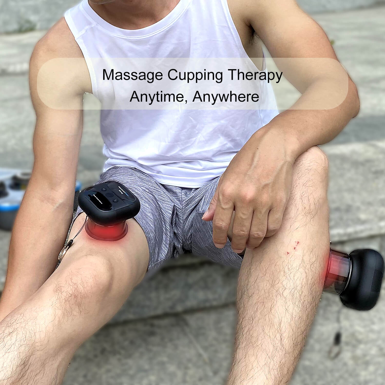 cupping anytime anywhere